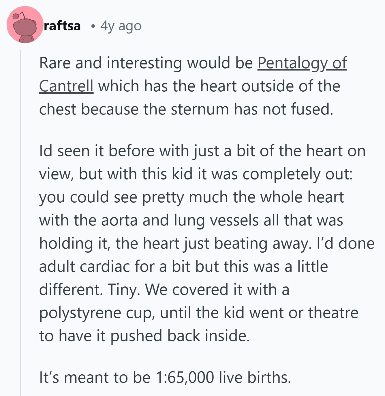 raftsa 4y ago Rare and interesting would be Pentalogy_of Cantrell which has the heart outside of the chest because the sternum has not fused. Id seen it before with just a bit of the heart on view, but with this kid it was completely out: you could see pretty much the whole heart with the aorta and lung vessels all that was holding it, the heart just beating away. I'd done adult cardiac for a bit but this was a little different. Tiny. We covered it with a polystyrene cup, until the kid went or theatre to have it pushed 