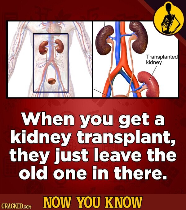 Transplanted kidney When you get a kidney transplant, they just leave the old one in there. NOW YOU KNOW CRACKED.COM