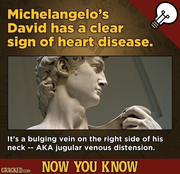 Michelangelo's David has a clear sign of heart disease. It's a bulging vein on the right side of his neck - AKA jugular venous distension. NOW YOU KNOW CRACKED.COM