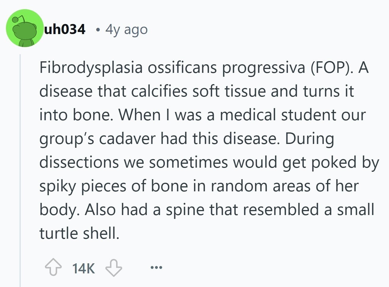 uh034 4y ago Fibrodysplasia ossificans progressiva (FOP). A disease that calcifies soft tissue and turns it into bone. When | was a medical student our group's cadaver had this disease. During dissections we sometimes would get poked by spiky pieces of bone in random areas of her body. Also had a spine that resembled a small turtle shell. 14K ... 