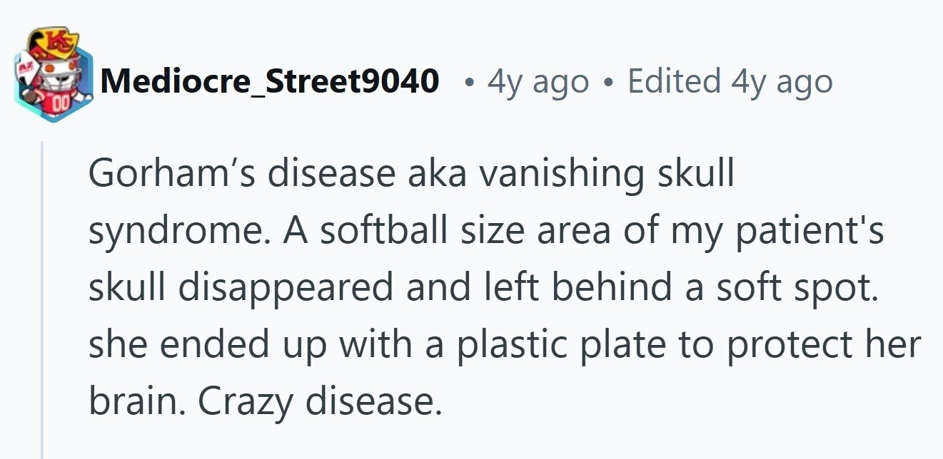 KS AZ - Mediocre_Street9040 4y ago Edited 4y ago 00 Gorham's disease aka vanishing skull syndrome. A softball size area of my patient's skull disappeared and left behind a soft spot. she ended up with a plastic plate to protect her brain. Crazy disease. 