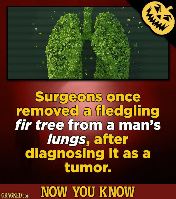 Surgeons once removed a fledgling fir tree from a man's lungs, after diagnosing it as a tumor. NOW YOU KNOW CRACKED.COM