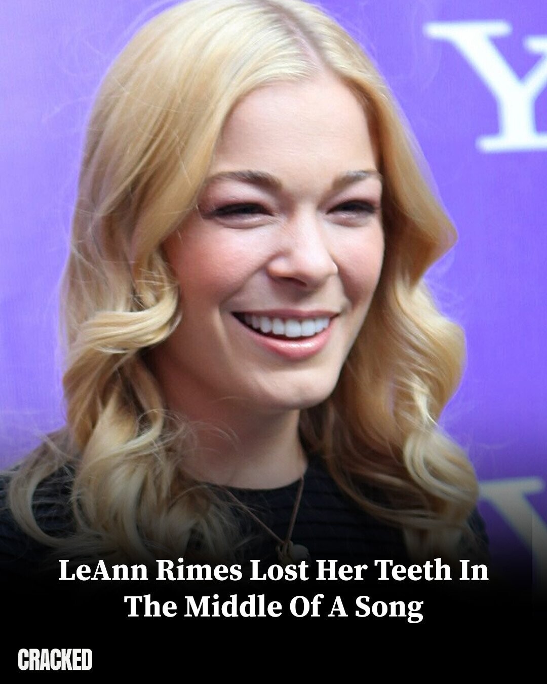 LeAnn Rimes Lost Her Teeth In The Middle Of A Song CRACKED