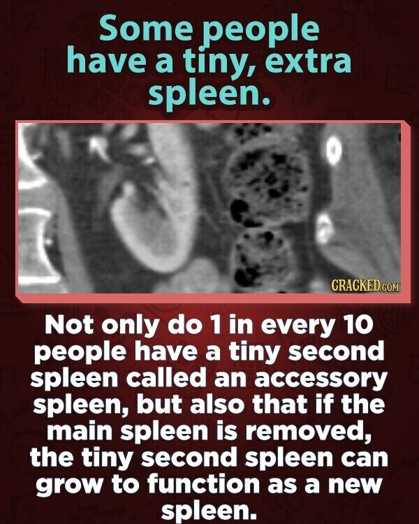 Some people have a tiny, extra spleen. CRACKED COM Not only do 1 in every 10 people have a tiny second spleen called an accessory spleen, but also that if the main spleen is removed, the tiny second spleen can grow to function as a new spleen.