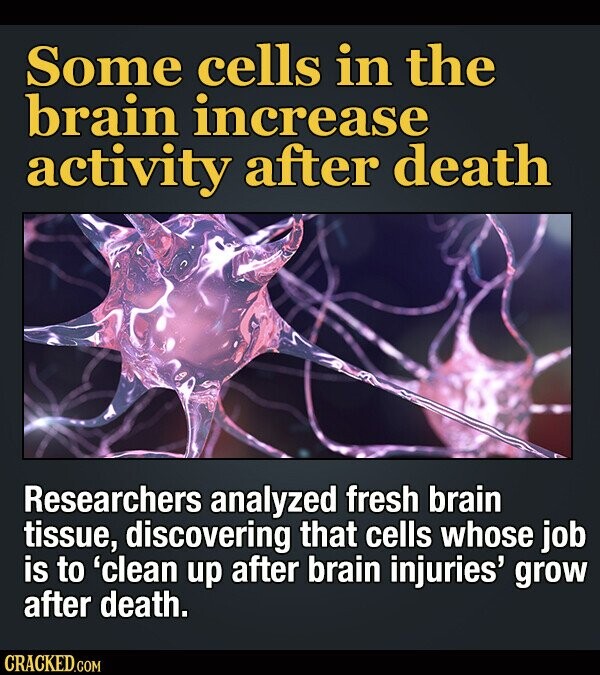 Some cells in the brain increase activity after death Researchers analyzed fresh brain tissue, discovering that cells whose job is to 'clean up after brain injuries' grow after death. CRACKED.COM