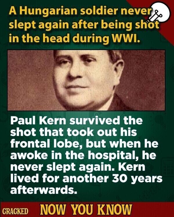 A Hungarian soldier never slept again after being shot in the head during WWI. Paul Kern survived the shot that took out his frontal lobe, but when he awoke in the hospital, he never slept again. Kern lived for another 30 years afterwards. CRACKED NOW YOU KNOW
