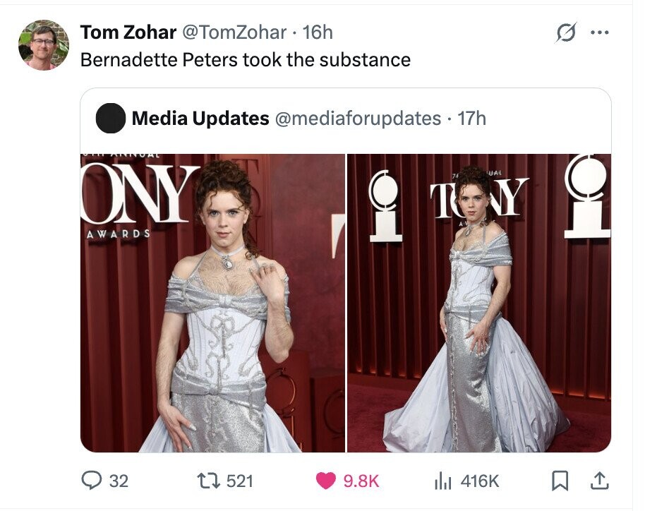 Tom Zohar @TomZohar 16h ... Bernadette Peters took the substance Media Updates @mediaforupdates . 17h ONY UAL 74 Y T - AWARDS 32 521 9.8K del 416K