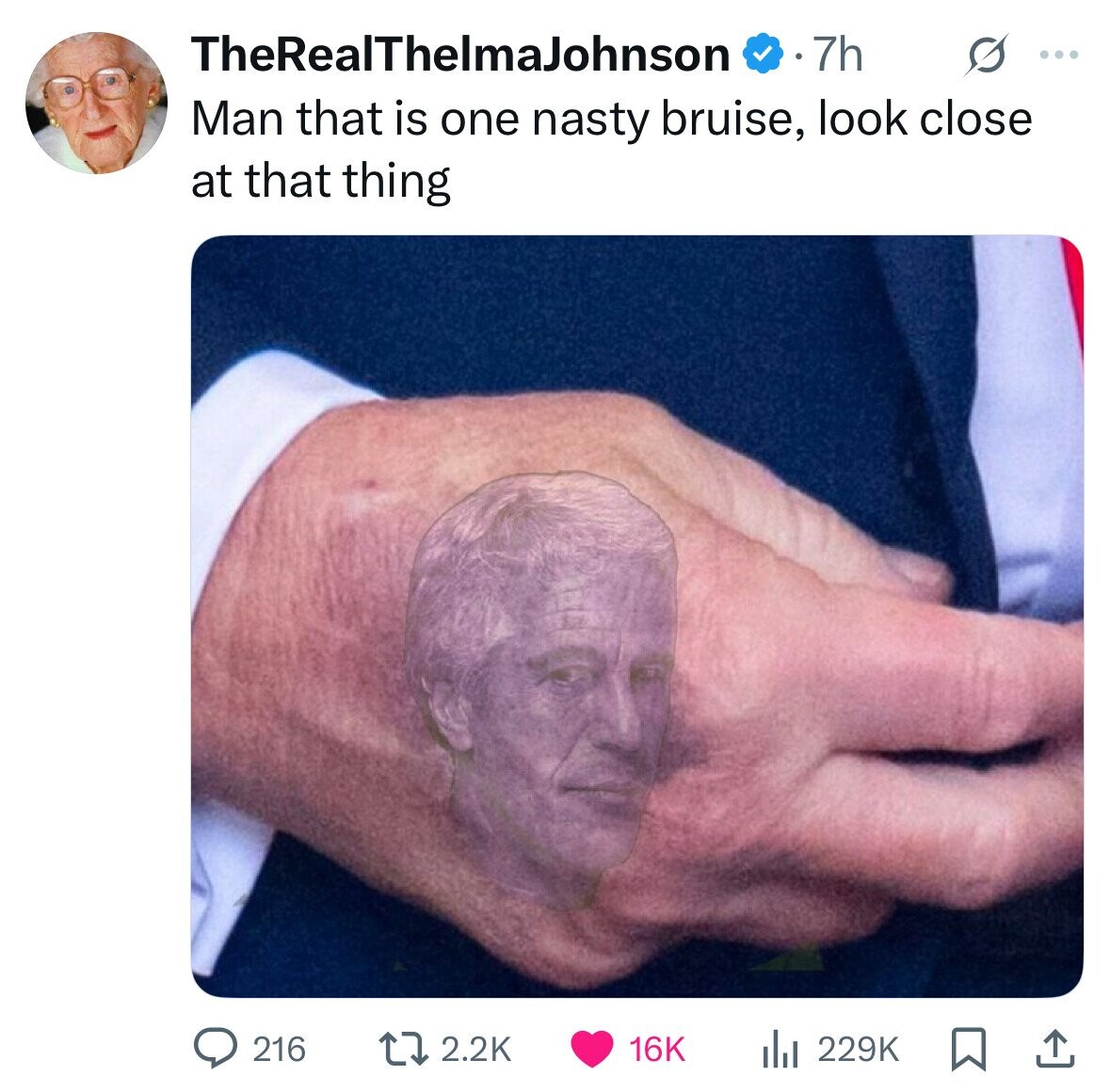 TheRealThelmaJohnson 7h G ... Man that is one nasty bruise, look close at that thing 2.2K 216 229K 16K 