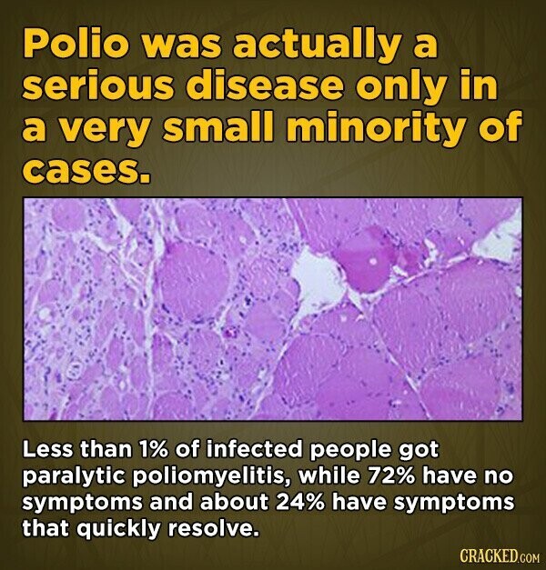 Polio was actually a serious disease only in a very small minority of cases. Less than 1% of infected people got paralytic poliomyelitis, while 72% have no symptoms and about 24% have symptoms that quickly resolve. CRACKED.COM