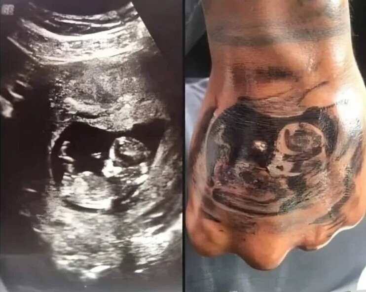 Bad Tattoos That Aren’t Going Anywhere