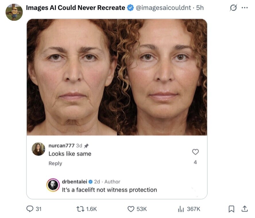 s ... Images AI Could Never Recreate @imagesaicouldnt . 5h nurcan777 3d Looks like same 4 Reply 2d Author drbentalei It's a facelift not witness protection 31 1.6K 53K 367K 
