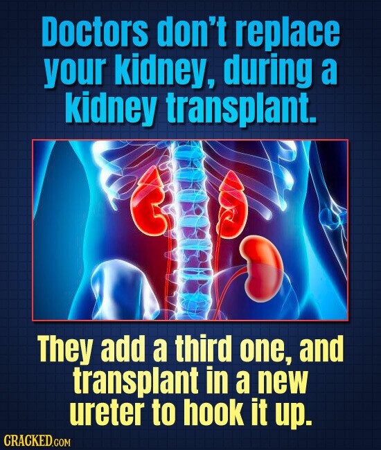 Doctors don't replace your kidney, during a kidney transplant. They add a third one, and transplant in a new ureter to hook it up. CRACKED.COM