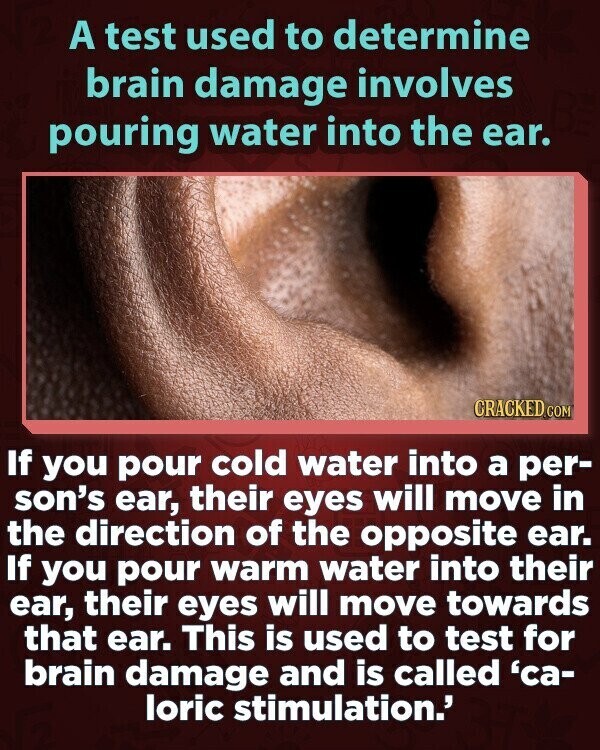 A test used to determine brain damage involves pouring water into the ear. CRACKED.COM If you pour cold water into a per- son's ear, their eyes will move in the direction of the opposite ear. If you pour warm water into their ear, their eyes will move towards that ear. This is used to test for brain damage and is called 'ca- loric stimulation.'