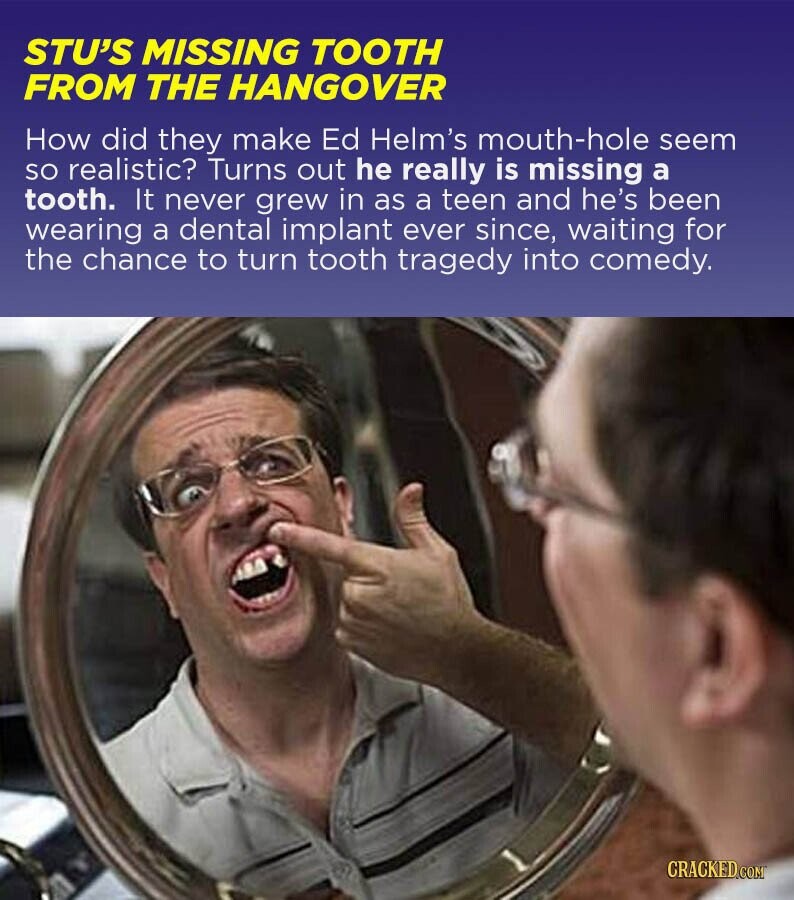 STU'S MISSING TOOTH FROM THE HANGOVER How did they make Ed Helm's mouth-hole seem so realistic? Turns out he really is missing a tooth. It never grew in as a teen and he's been wearing a dental implant ever since, waiting for the chance to turn tooth tragedy into comedy. CRACKED.COM