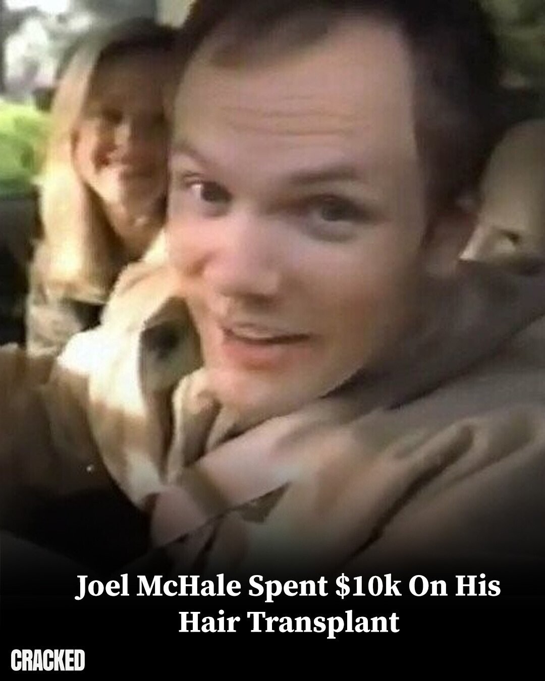 Joel McHale Spent $10k On His Hair Transplant CRACKED