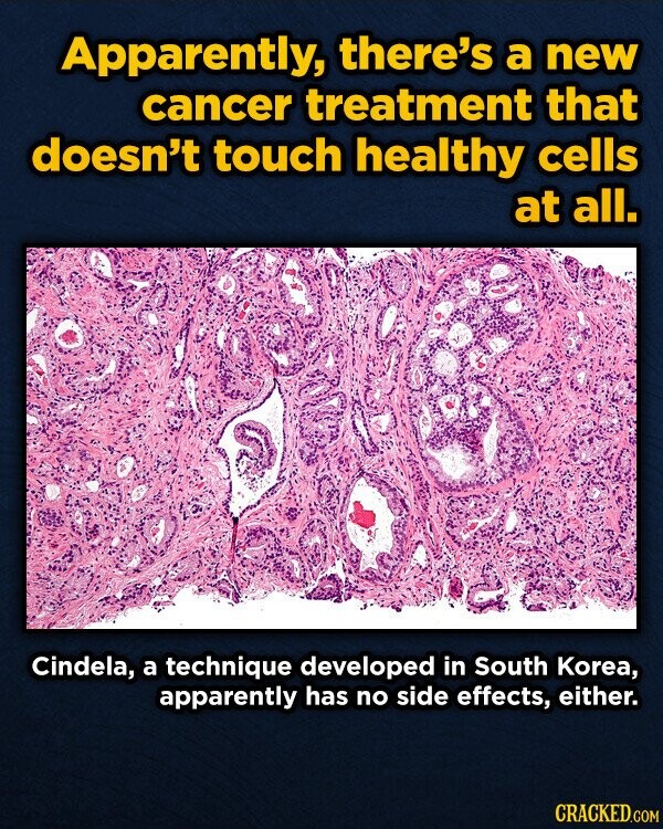 Apparently, there's a new cancer treatment that doesn't touch healthy cells at all. Cindela, a technique developed in South Korea, apparently has no side effects, either. CRACKED.COM