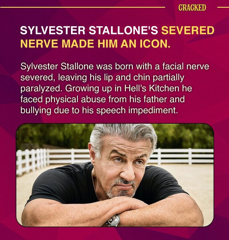 CRACKED SYLVESTER STALLONE'S SEVERED NERVE MADE HIM AN ICON. Sylvester Stallone was born with a facial nerve severed, leaving his lip and chin partially paralyzed. Growing up in Hell's Kitchen he faced physical abuse from his father and bullying due to his speech impediment.