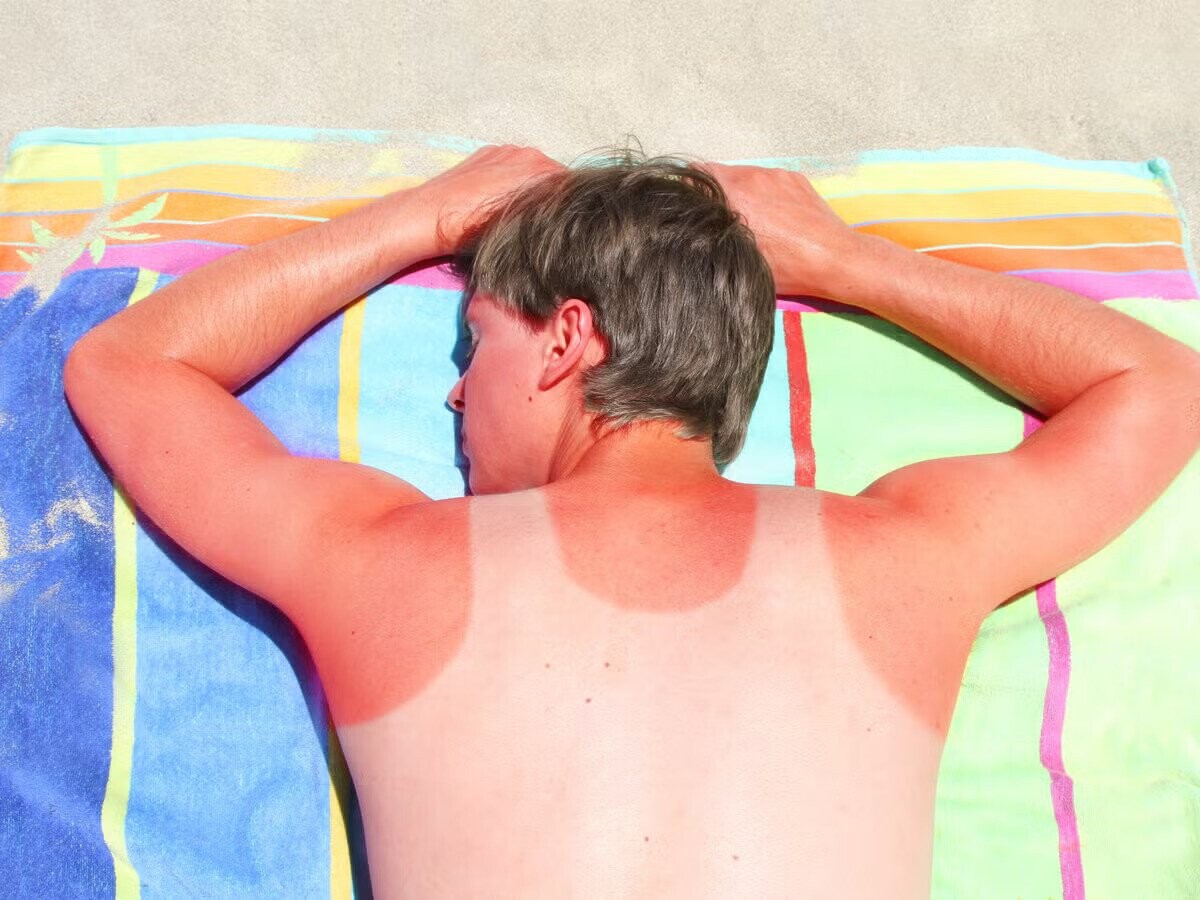 Beach Photos Obviously from Before the Days of SPF