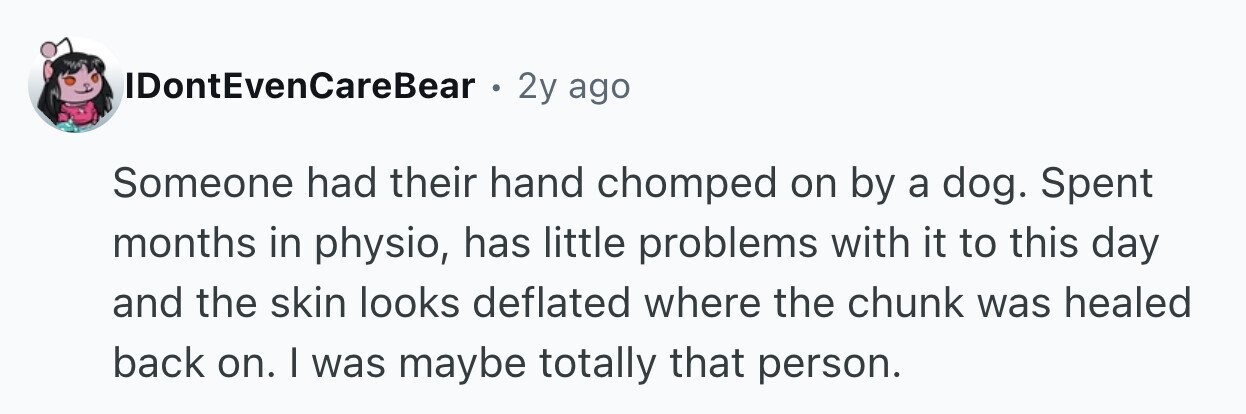 IDontEvenCareBear . 2y ago Someone had their hand chomped on by a dog. Spent months in physio, has little problems with it to this day and the skin looks deflated where the chunk was healed back on. I was maybe totally that person.