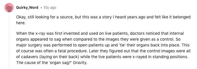Quirky_Word 10y ago Okay, still looking for a source, but this was a story I heard years ago and felt like it belonged here. When the x-ray was first invented and used on live patients, doctors noticed that internal organs appeared to sag when compared to the images they were given as a control. So major surgery was performed to open patients up and 'tie' their organs back into place. This of course was often a fatal procedure. Later they figured out that the control images were all of cadavers (laying on their back) while the live patients were x-rayed