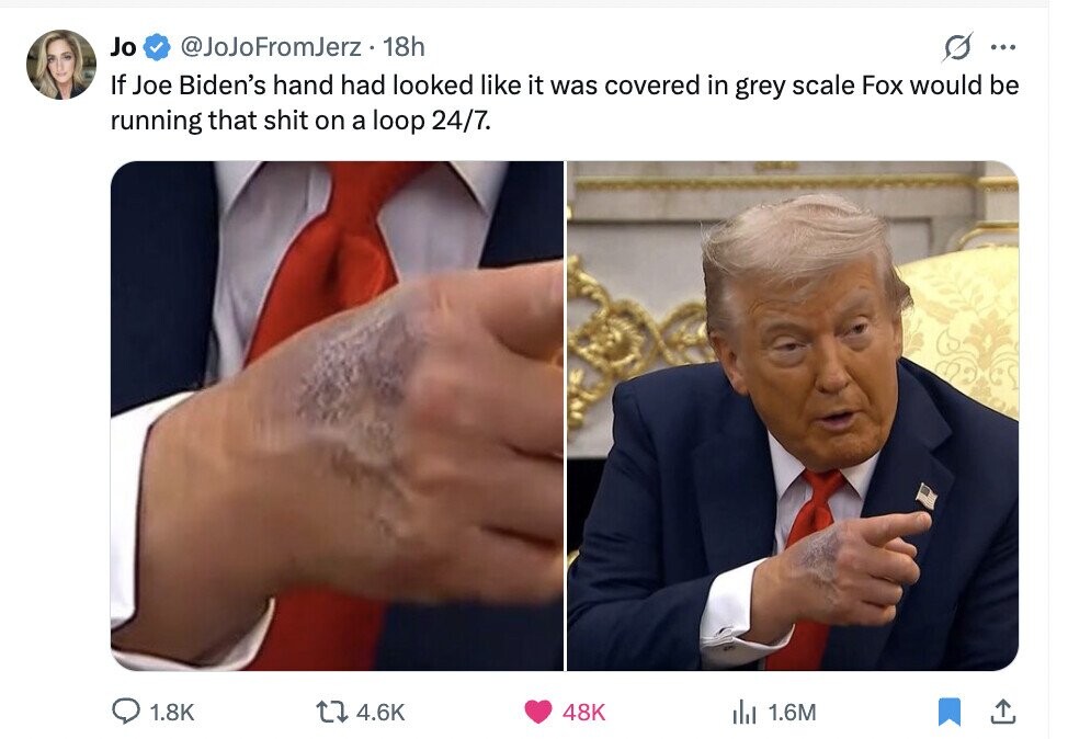 Jo @JoJoFromJerz. 18h O ... If Joe Biden's hand had looked like it was covered in grey scale Fox would be running that shit on a loop 24/7. 1.8K 4.6K 48K del 1.6M 