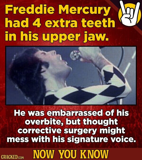 Freddie Mercury had 4 extra teeth in his upper jaw. Не was embarrassed of his overbite, but thought corrective surgery might mess with his signature voice. NOW YOU KNOW CRACKED.COM