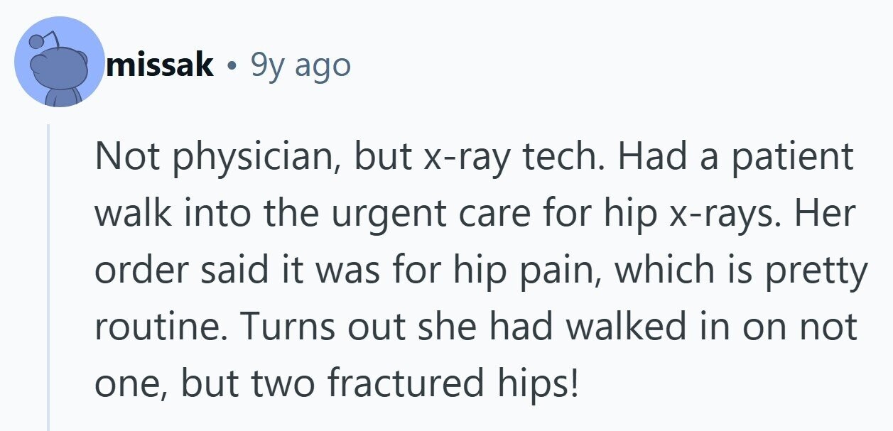 missak . 9y ago Not physician, but x-ray tech. Had a patient walk into the urgent care for hip x-rays. Her order said it was for hip pain, which is pretty routine. Turns out she had walked in on not one, but two fractured hips! 