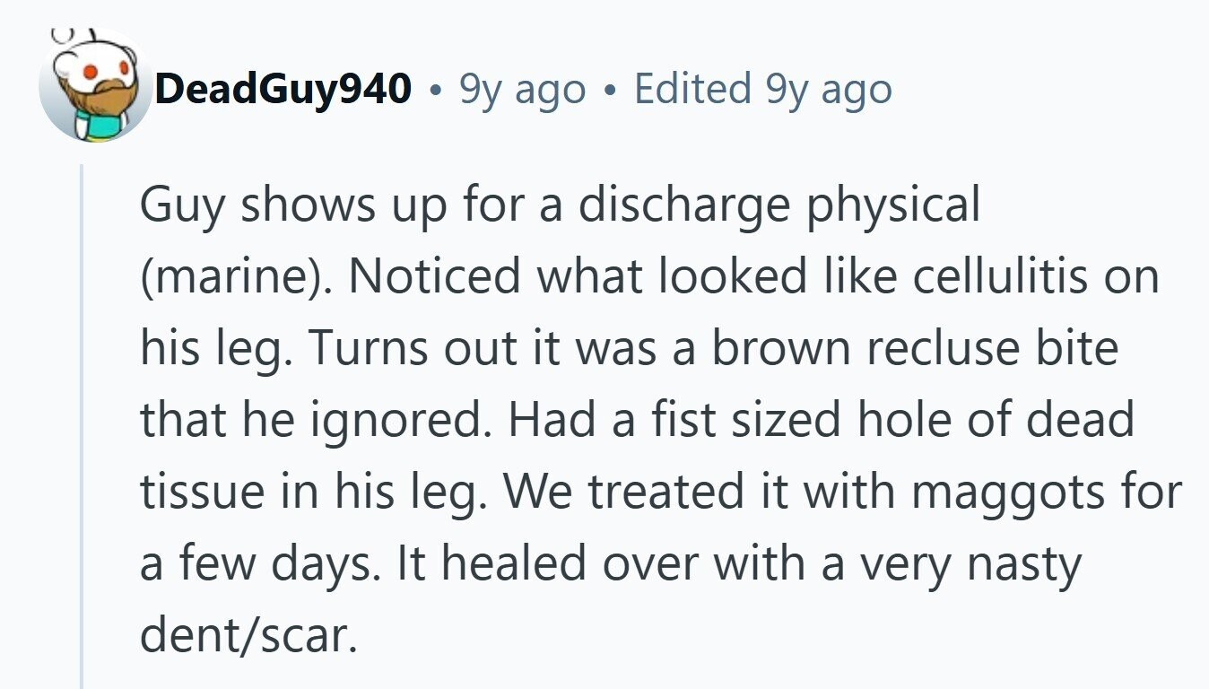DeadGuy940 9y ago Edited 9y ago Guy shows up for a discharge physical (marine). Noticed what looked like cellulitis on his leg. Turns out it was a brown recluse bite that he ignored. Had a fist sized hole of dead tissue in his leg. We treated it with maggots for a few days. It healed over with a very nasty dent/scar. 