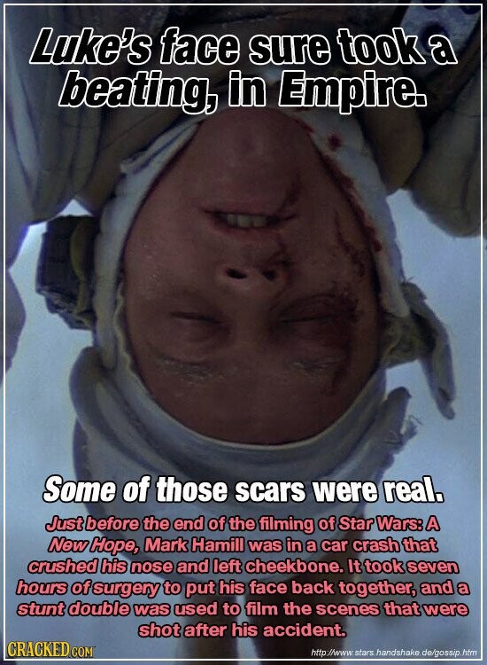 Luke's face sure took a beating, in Empire. Some of those scars were real. Just before the end of the filming of Star Wars: A New Hope, Mark Hamill was in a car crash that crushed his nose and left cheekbone. It took seven hours of surgery to put his face back together, and a stunt double was used to film the scenes that were shot after his accident. CRACKED COM http://www. stars handshake de/gossip htm