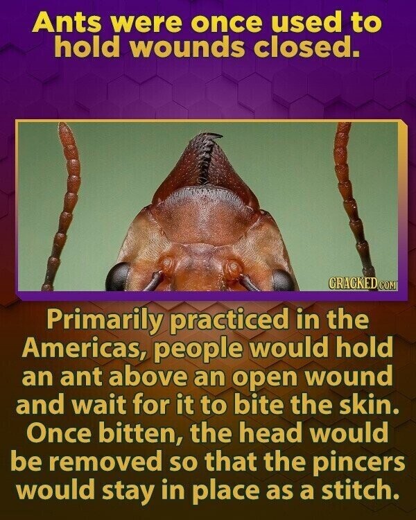 Ants were once used to hold wounds closed. CRACKED COM Primarily practiced in the Americas, people would hold an ant above an open wound and wait for it to bite the skin. Once bitten, the head would be removed so that the pincers would stay in place as a stitch.
