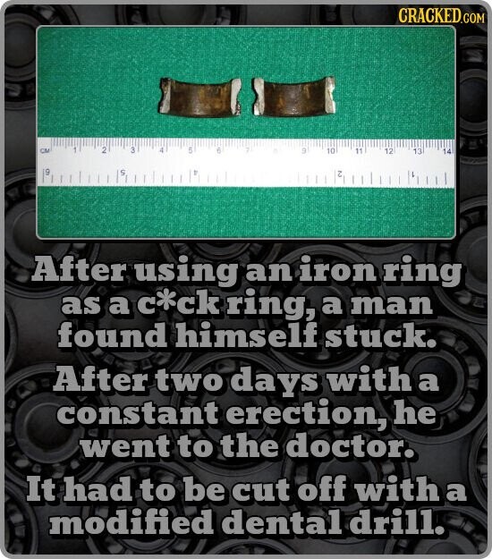 CRACKED.COM 1 CM 2 3 4 5 6 9 10 11 12 13 14 19 9 1 Z After using an iron ring as a с*ck ring, a man found himself stuck. After two days with a constant erection, he went to the doctor. It had to be cut off with a modified dental drill.