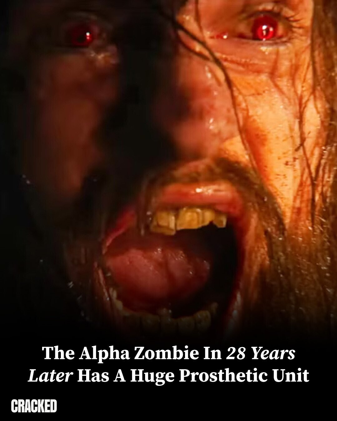 The Alpha Zombie In 28 Years Later Has A Huge Prosthetic Unit CRACKED