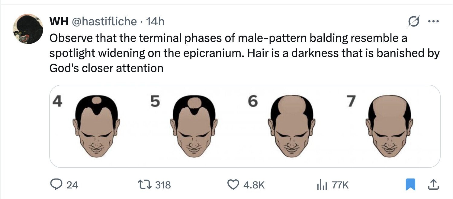 WH @hastifliche 14h ... Observe that the terminal phases of male-pattern balding resemble a spotlight widening on the epicranium. Hair is a darkness that is banished by God's closer attention 4 5 6 7 24 318 4.8K del 77K 