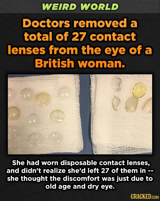 WEIRD WORLD Doctors removed a total of 27 contact lenses from the eye of a British woman. She had worn disposable contact lenses, and didn't realize she'd left 27 of them in she thought the discomfort was just due to old age and dry eye. CRACKED.COM