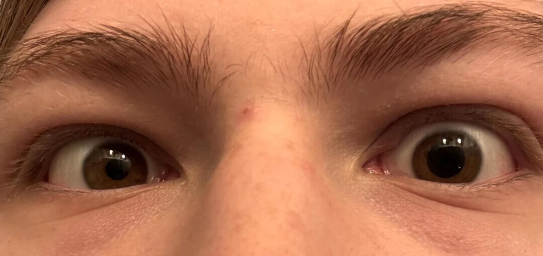 One-in-a-Million Shots That Could Never Happen Again