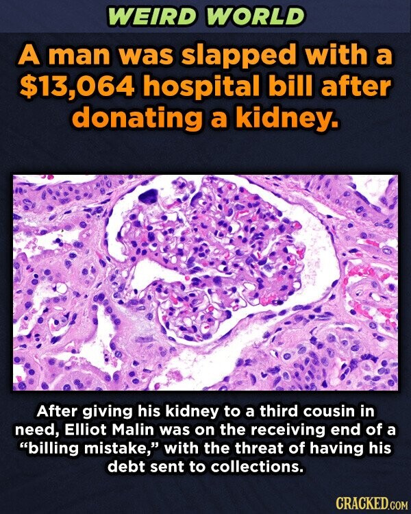 WEIRD WORLD A man was slapped with a $13,064 hospital bill after donating a kidney. After giving his kidney to a third cousin in need, Elliot Malin was on the receiving end of a billing mistake, with the threat of having his debt sent to collections. CRACKED.COM