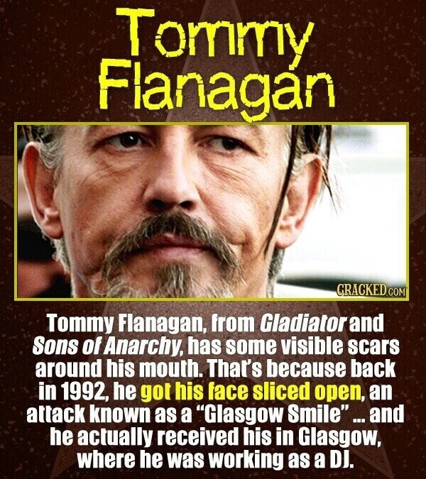 Tommy Flanagán CRACKED.COM Tommy Flanagan, from Gladiator and Sons of Anarchy, has some visible scars around his mouth. That's because back in 1992, he got his face sliced open, an attack known as a Glasgow Smile and he actually received his in Glasgow, where he was working as a DI.