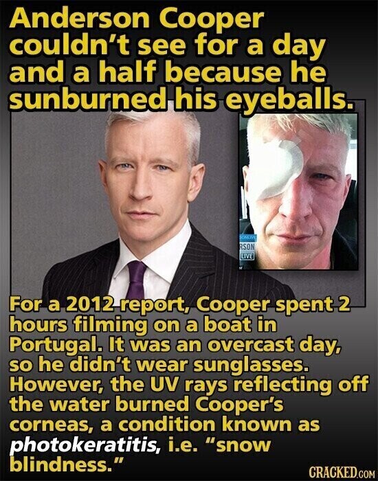 Anderson Cooper couldn't see for a day and a half because he sunburned his eyeballs. SONLIVE RSON LIVE For a 2012 report, Cooper spent 2 hours filming on a boat in Portugal. It was an overcast day, so he didn't wear sunglasses. However, the UV rays reflecting off the water burned Cooper's corneas, a condition known as photokeratitis, i.e. snow blindness. CRACKED.COM