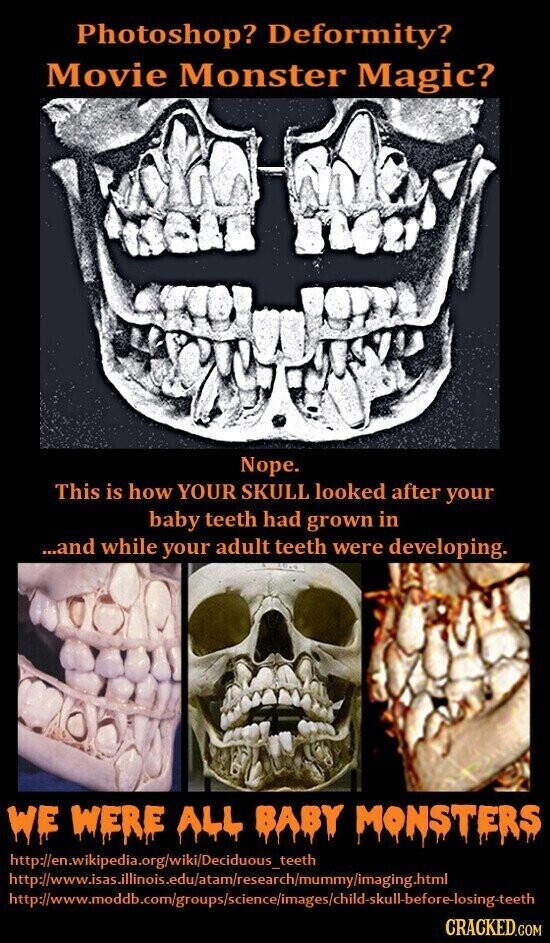 Photoshop? Deformity? Movie Monster Magic? Nope. This is how YOUR SKULL looked after your baby teeth had grown in ...and while your adult teeth were developing. WE WERE ALL BABY MONSTERS http://en.wikipedia.org/wiki/Deciduous_teeth http://www.isas.illinois.edu/atam/research/mummy/imaging.html http://www.moddb.com/groups/science/images/child-skull-before-losing-teeth CRACKED.COM