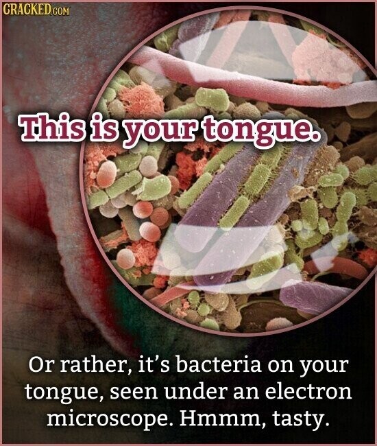 CRACKED.COM This is your tongue. Or rather, it's bacteria on your tongue, seen under an electron microscope. Hmmm, tasty.