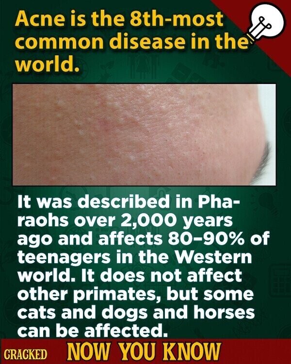 Acne is the 8th-most common disease in the world. It was described in Pha- raohs over 2,000 years ago and affects 80-90% of teenagers in the Western world. It does not affect other primates, but some cats and dogs and horses can be affected. CRACKED NOW YOU KNOW