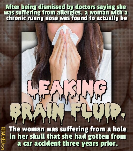 After being dismissed by doctors saying she was suffering from allergies, a woman with a chronic runny nose was found to actually be LEAKING BRAIN FLUID, CRACKED COM The woman was suffering from a hole in her skull that she had gotten from a car accident three years prior.