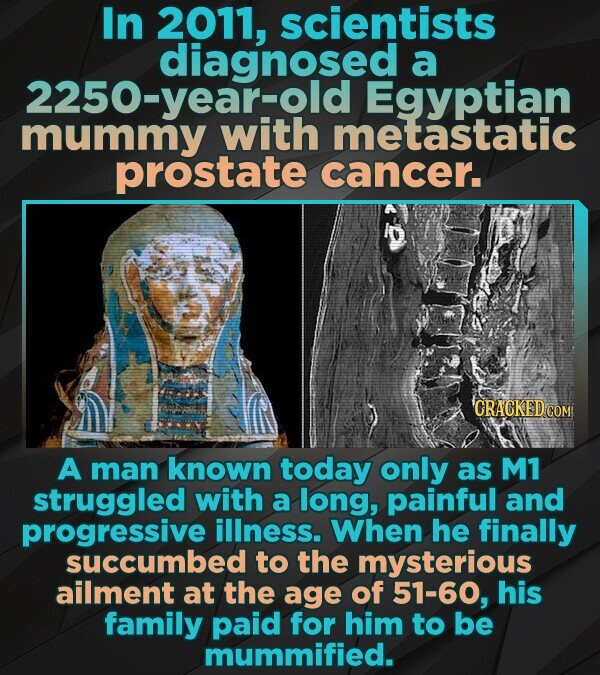 In 2011, scientists diagnosed a 2250-year-old Egyptian mummy with metastatic prostate cancer. GRACKED.COM A man known today only as M1 struggled with a long, painful and progressive illness. When he finally succumbed to the mysterious ailment at the age of 51-60, his family paid for him to be mummified.