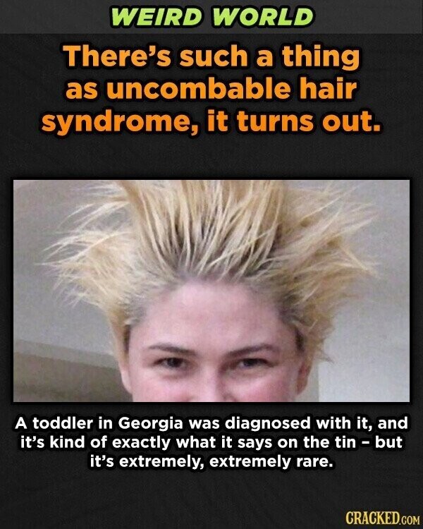 WEIRD WORLD There's such a thing as uncombable hair syndrome, it turns out. A toddler in Georgia was diagnosed with it, and it's kind of exactly what it says on the tin - but it's extremely, extremely rare. CRACKED.COM