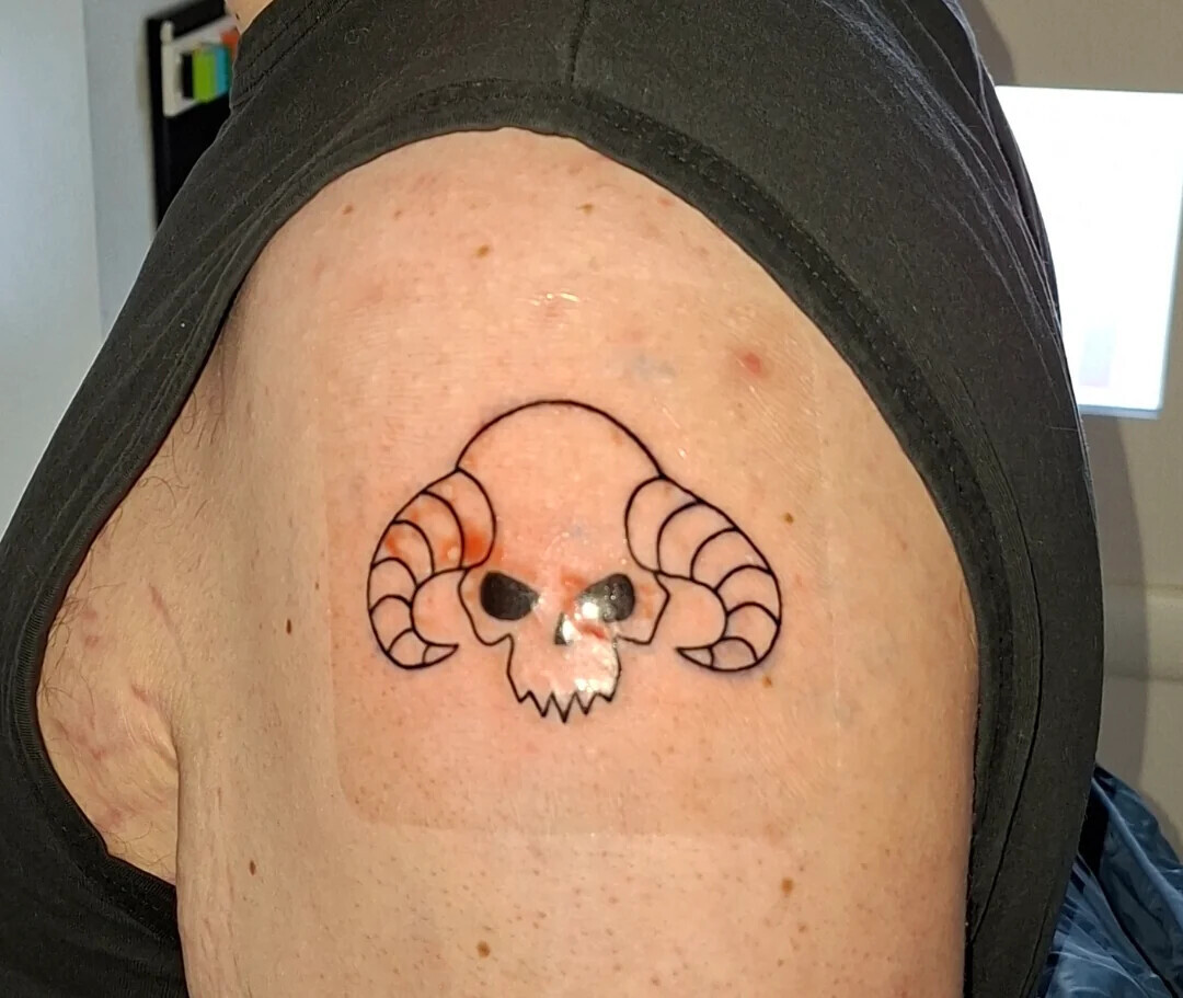 20 Tattoos Where a Removal Would Benefit Everyone