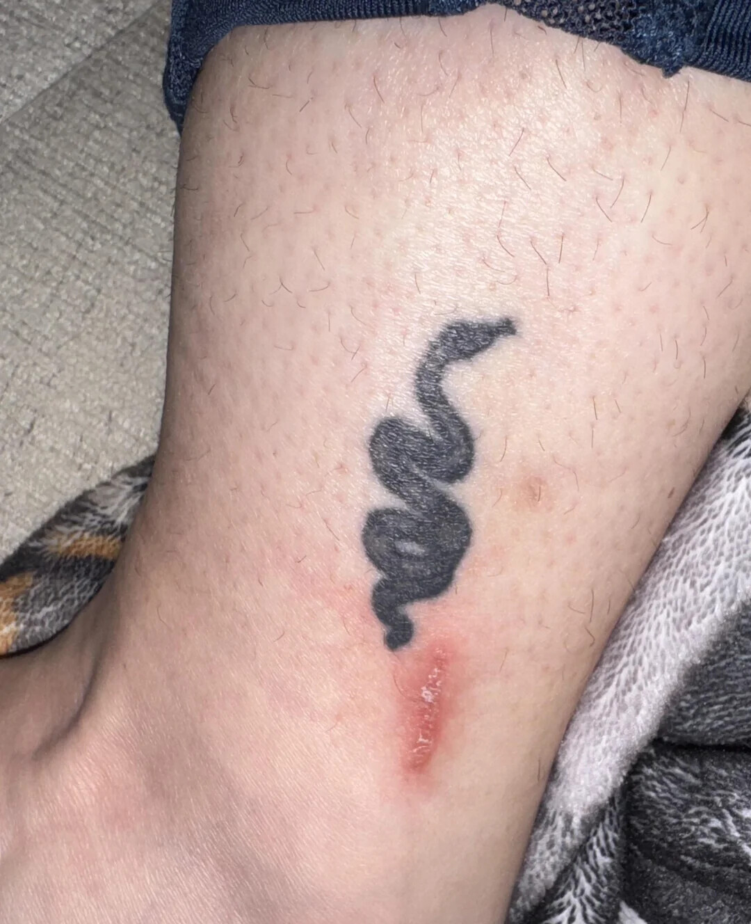 20 Tattoos Where a Removal Would Benefit Everyone