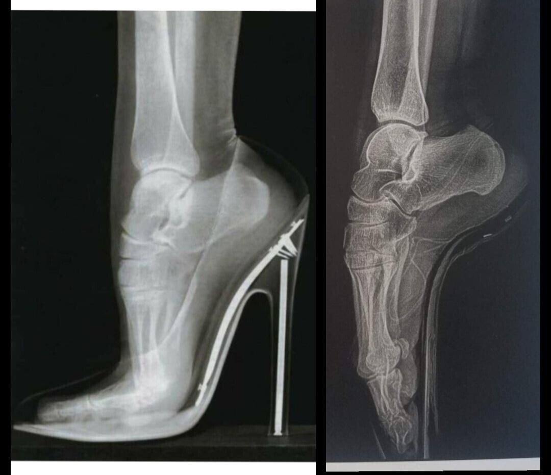 Candid Photos Looking Behind the Scenes at Life