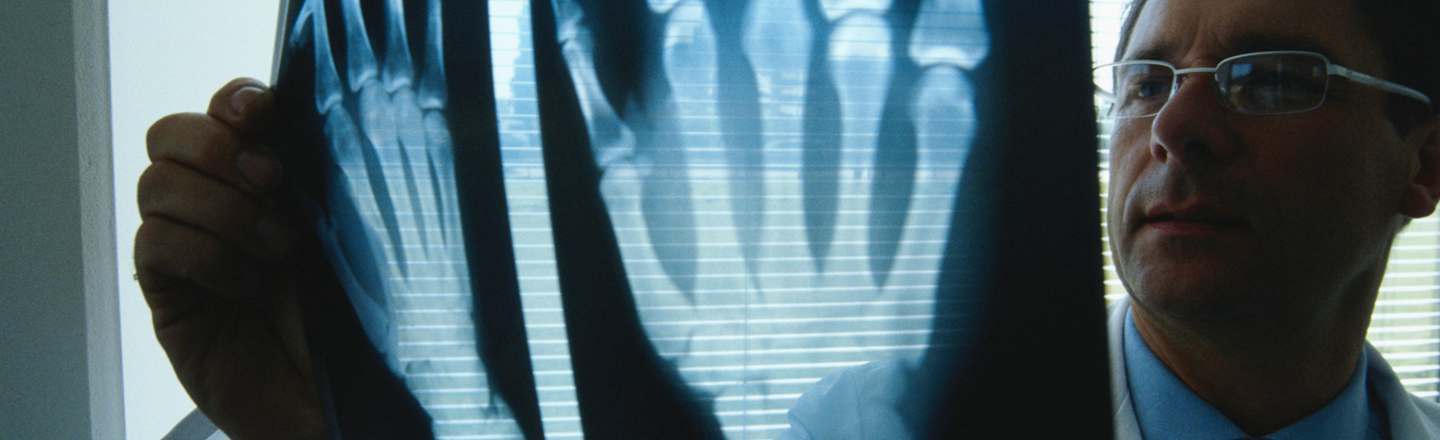 I Got A Hand Transplant: 5 Horrifying Realities