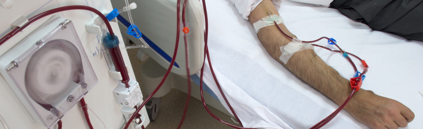No Peeing, Or Beer: 6 Realities Of Life Without Kidneys