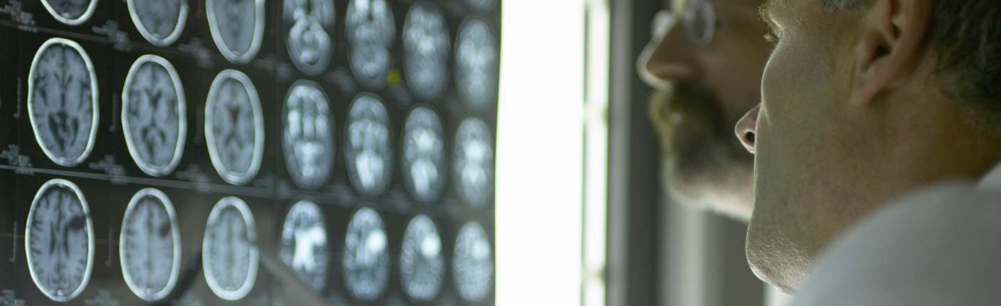You Might Have One & Not Know It: 6 Realities Of Aneurysms